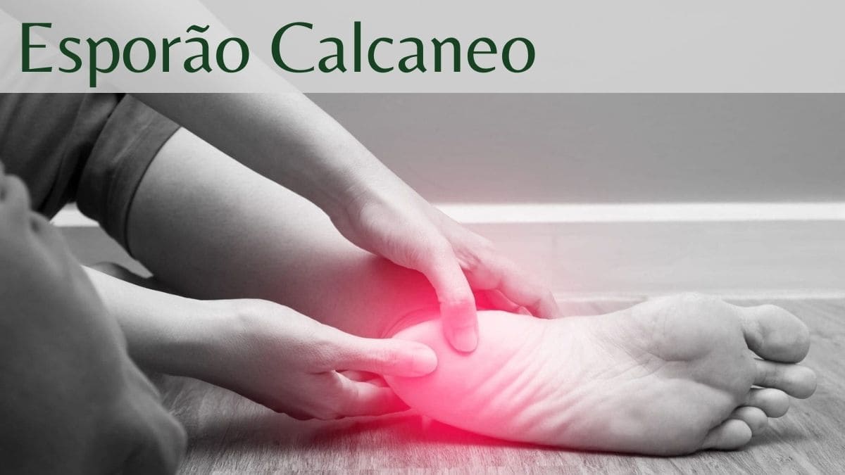 Esporão Calcaneo